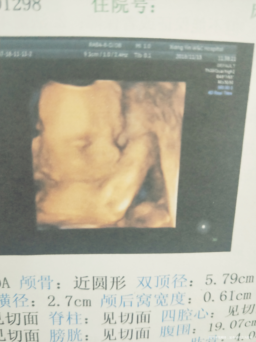 今日做了四维一切都正常!好好奇是男孩还是女孩!