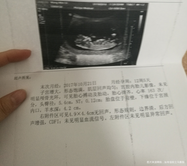 急急急,求助医生帮忙看看