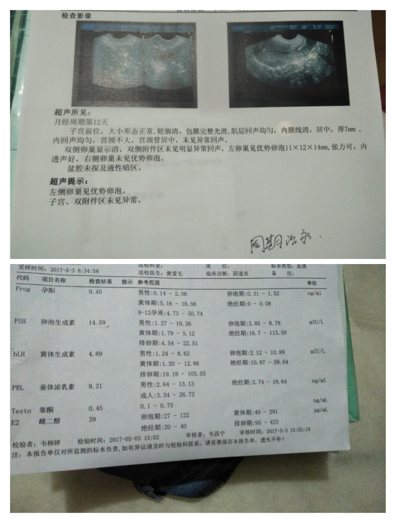 有在线的医生帮我看看这个检查报告