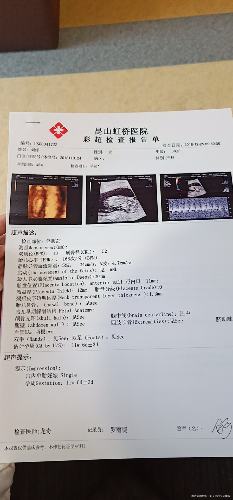 麻烦帮我看一下我胎盘是否正常 胎盘低吗?
