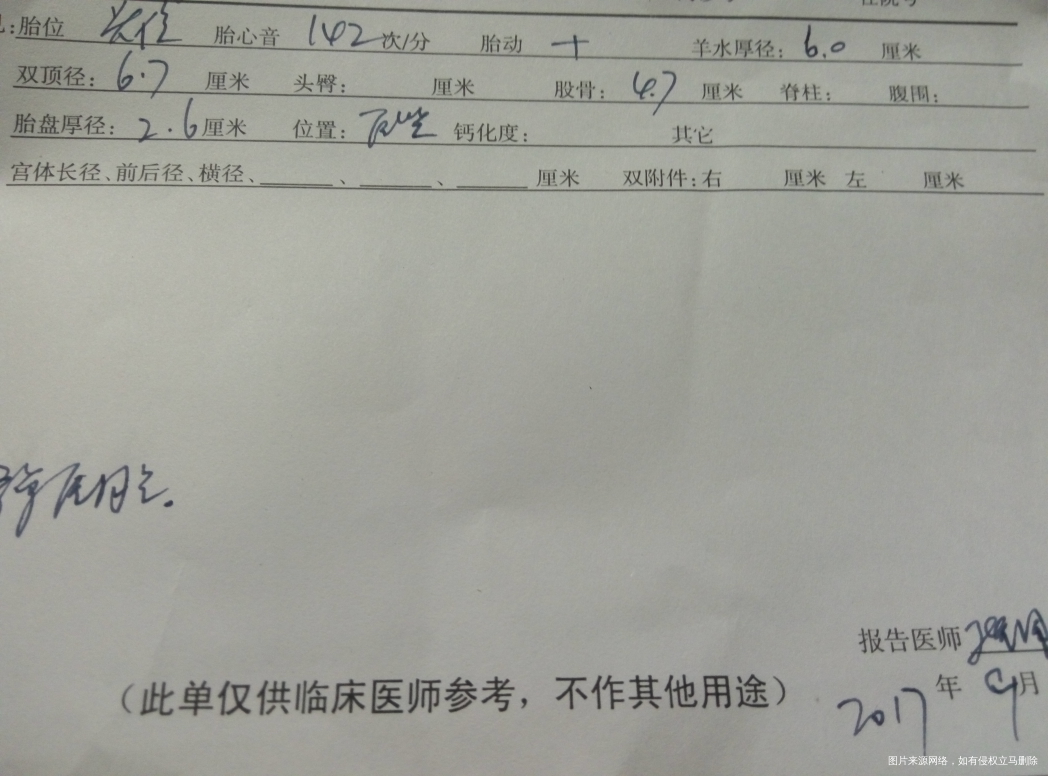 医生能帮我看看B超单吗?