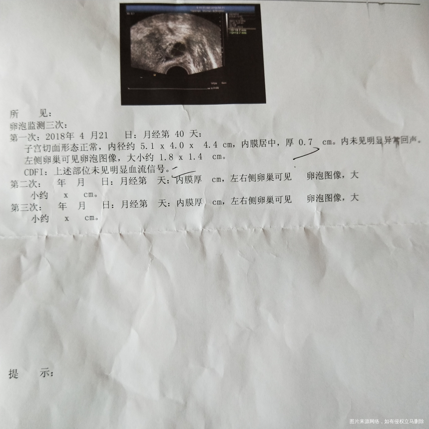 药流40天复查,医生帮忙看看!急急急