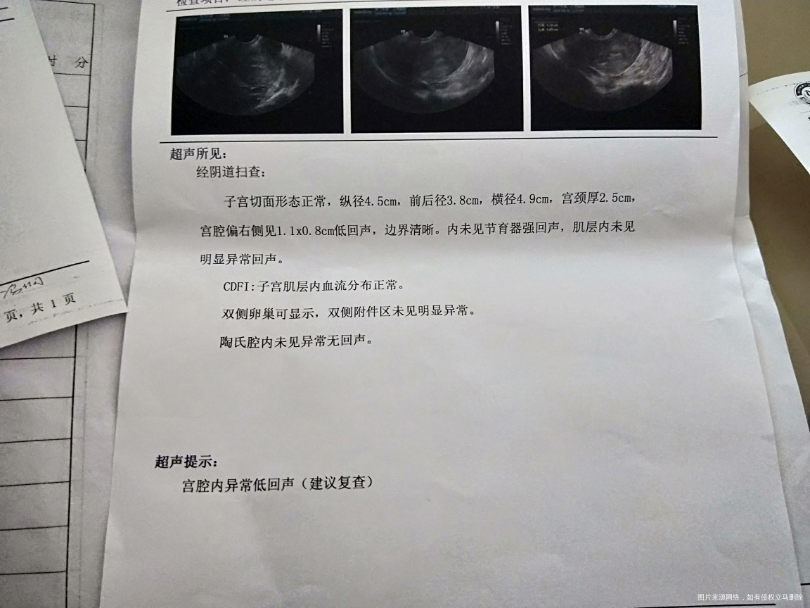 药流后来月经一直不走,这是检查结果,医生帮忙看看,怎么办