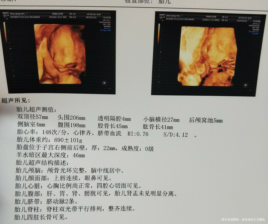 刚出炉的四维,姐妹们进来看下男女吧
