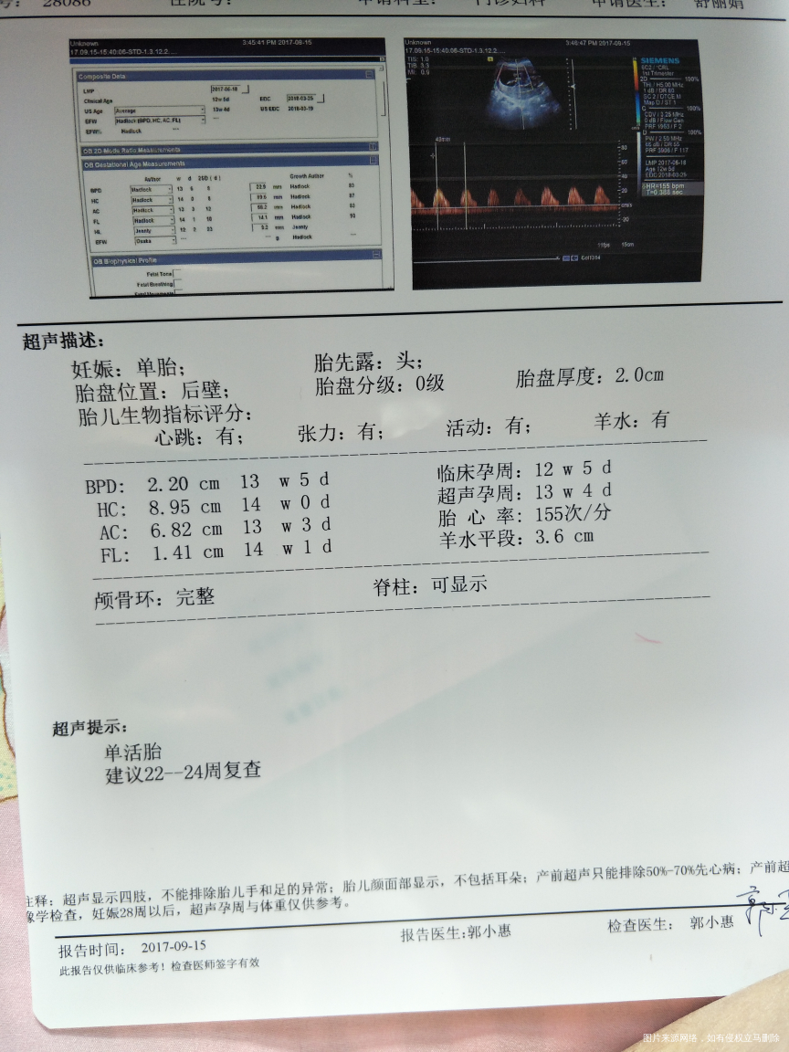 医生帮忙看一下了,谢谢!