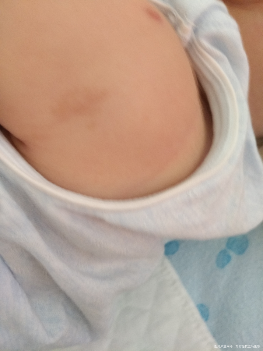 宝宝身上这种脏脏的东西是什么,洗不掉?