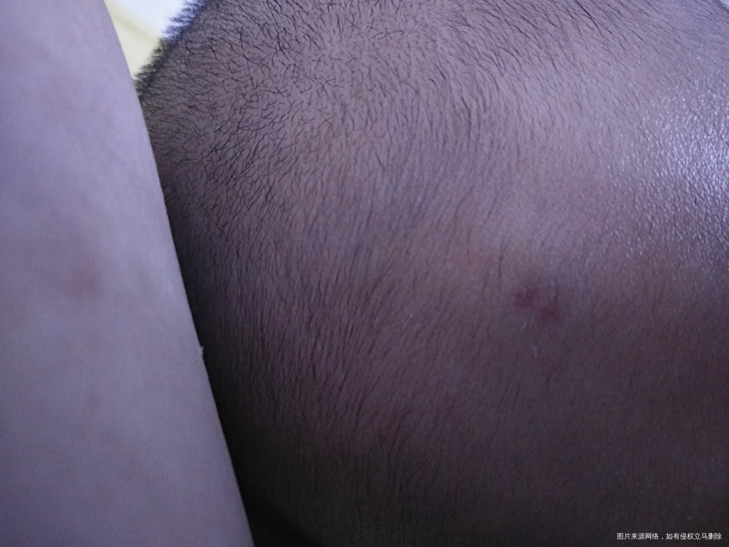 我想问下我女头上这个是什么情况