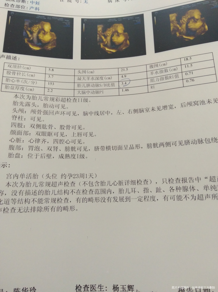 有在的医生麻烦帮忙看下,谢谢!