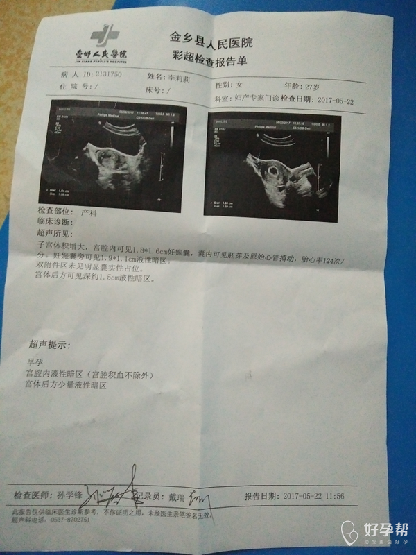 求助医生看看子宫有积液