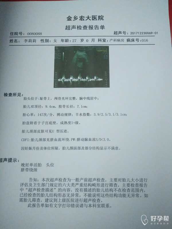 38 1刚做的彩超看看胎儿有多重