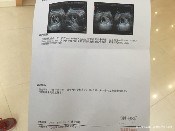 囊胚移植有胎心胎芽还会继续分裂吗?几率高吗?