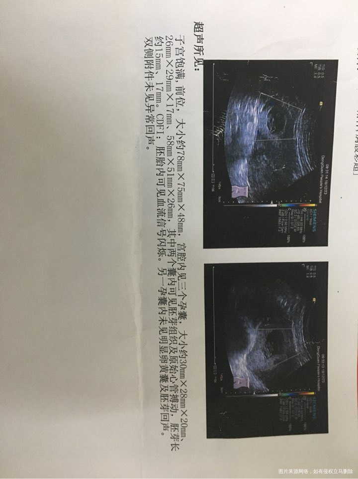 医生,这是正常吗?玻璃心!