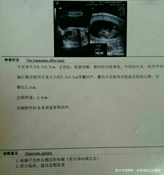 【孕妈的各种担心】你们经历过吗?🎉🎉