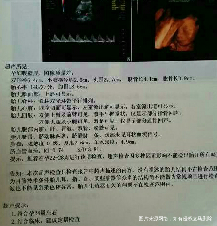 【孕妈的各种担心】你们经历过吗?🎉🎉