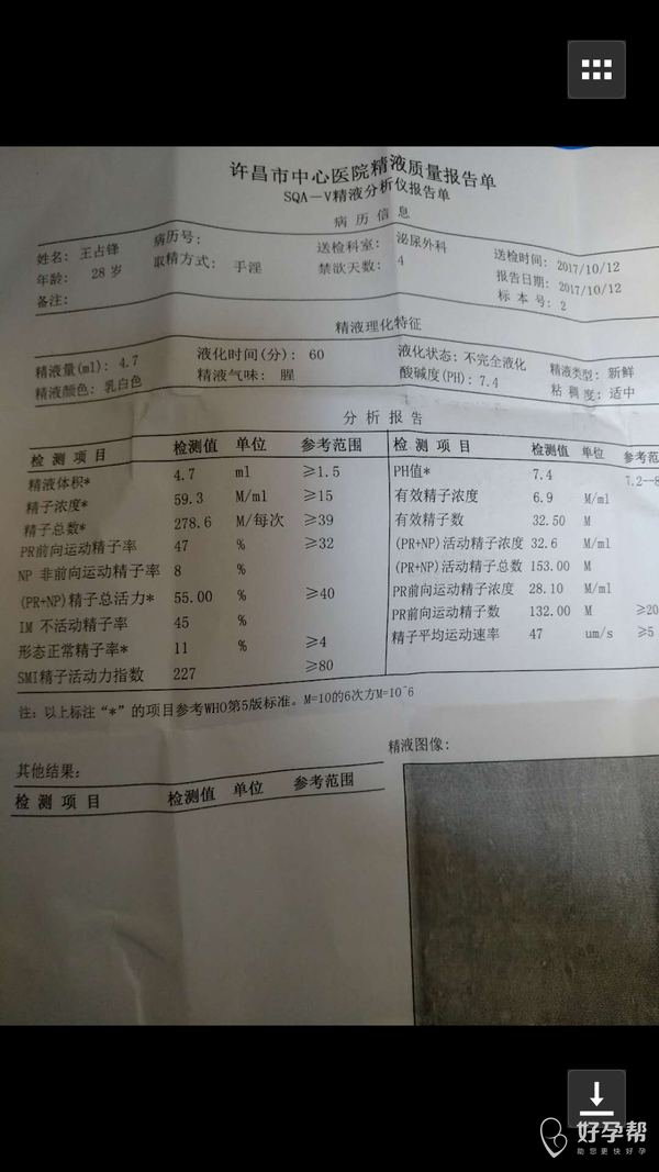 精子不完全液化怎么办