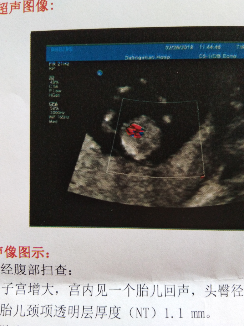 请医生帮忙看看,宝宝有多少克?