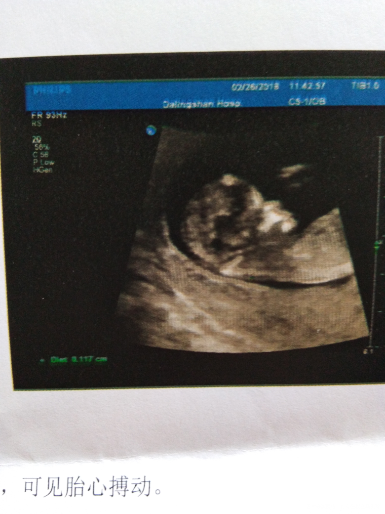 请医生帮忙看看,宝宝有多少克?