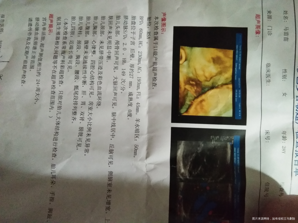 请医生帮忙看下我的糖筛和四维检查结果正常不,谢谢