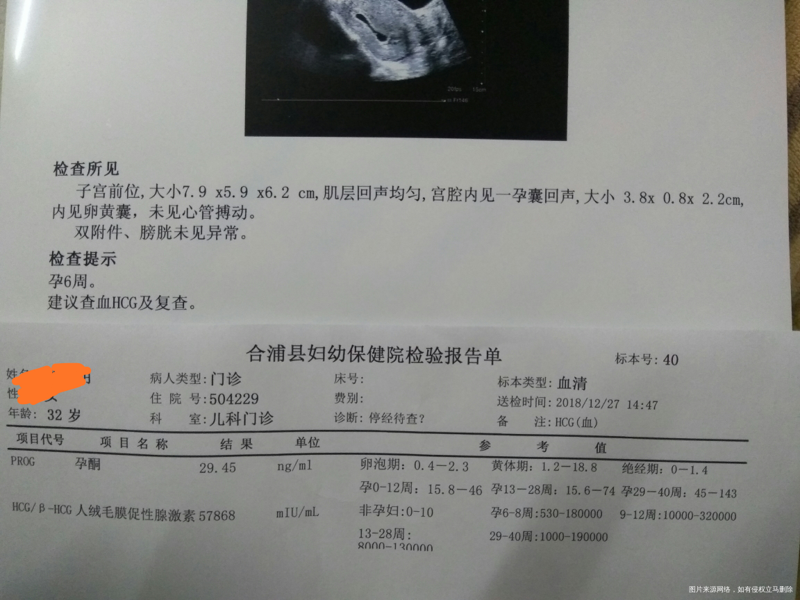 约6周未见心管博动,正常吗??