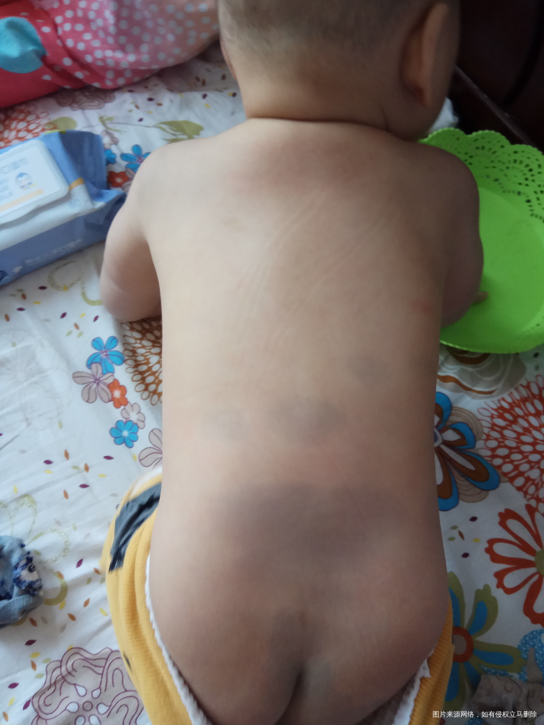 急急急 医生帮忙看看 突然好害怕