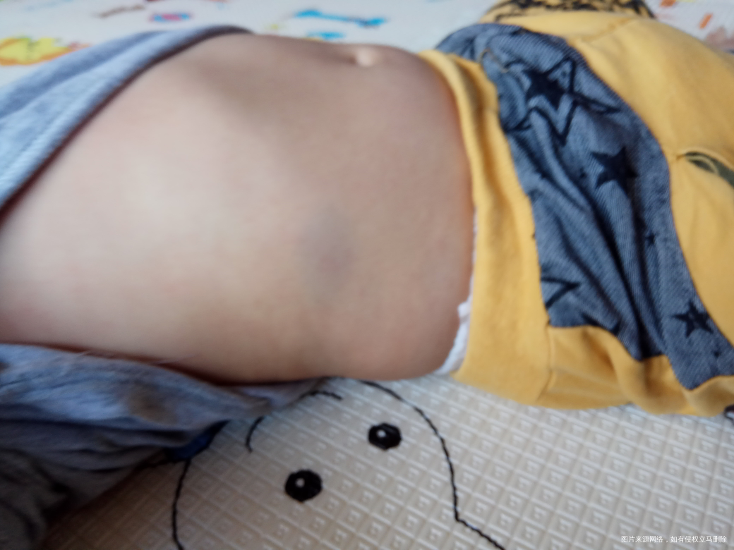 急急急 医生帮忙看看 突然好害怕