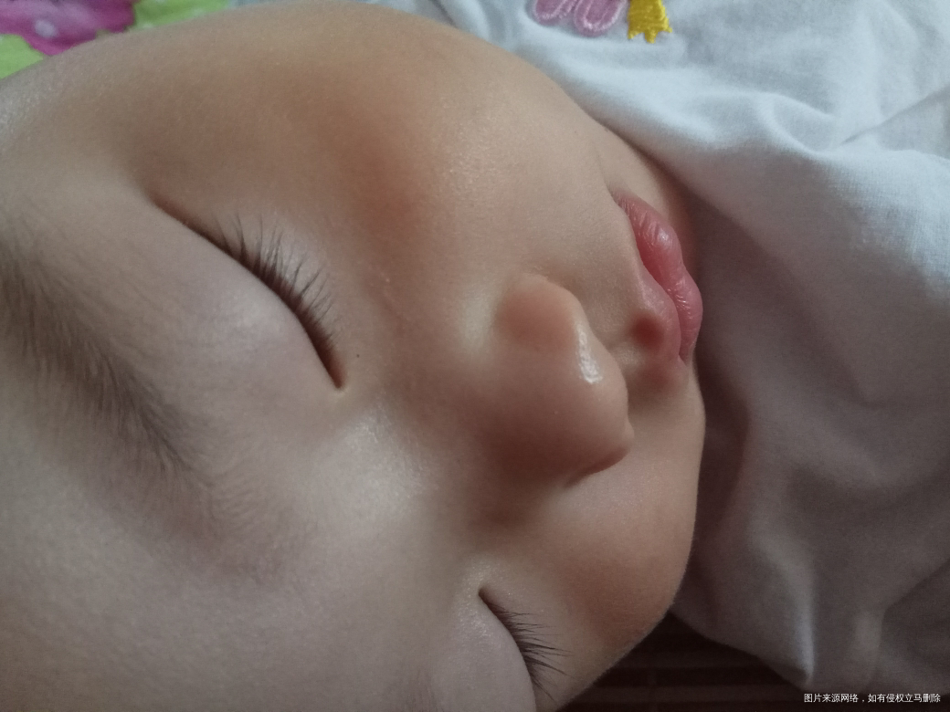 孩子脸被人家咬破皮了 好像留疤了怎么办