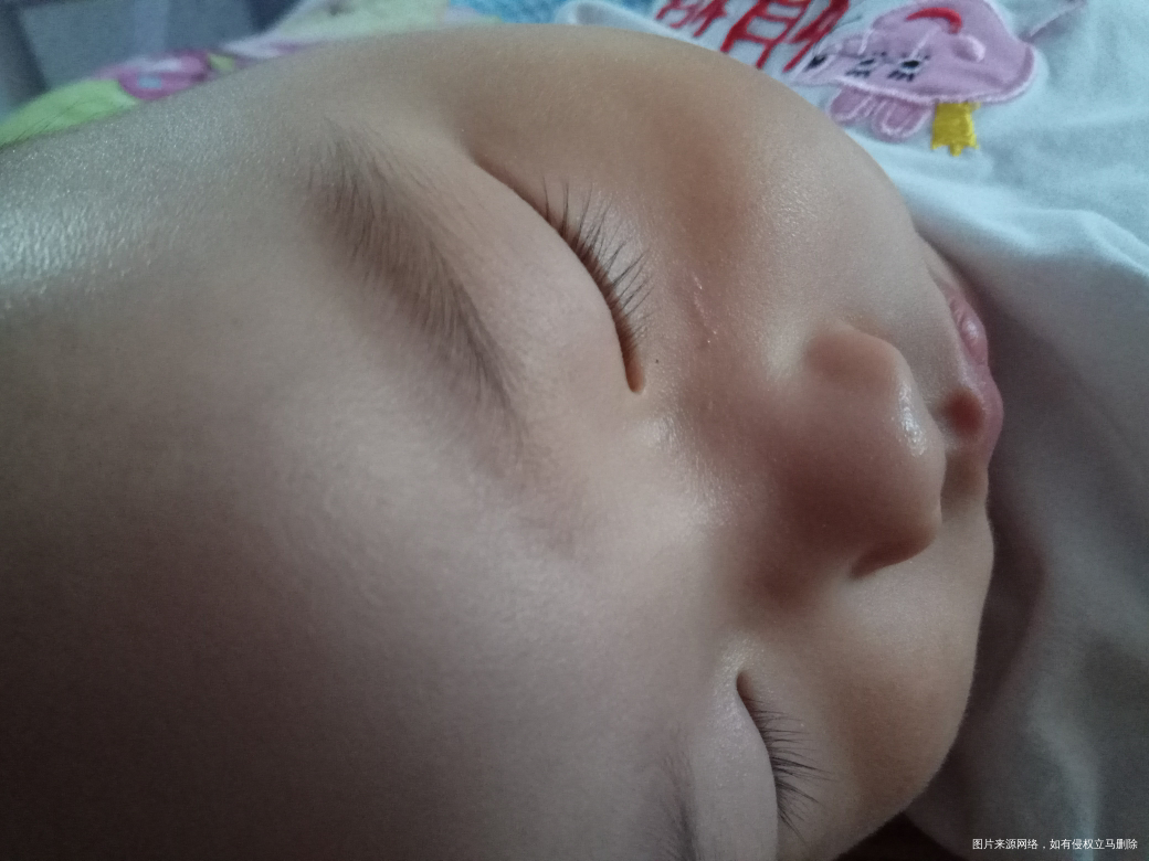 孩子脸被人家咬破皮了 好像留疤了怎么办