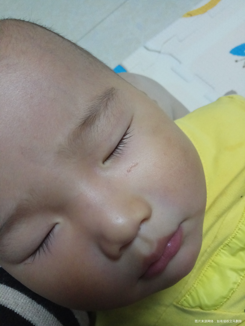 脸上 伤口上长的脂肪粒会自己恢复吗?