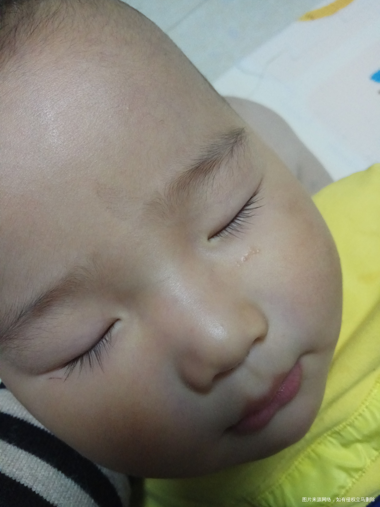 脸上 伤口上长的脂肪粒会自己恢复吗?