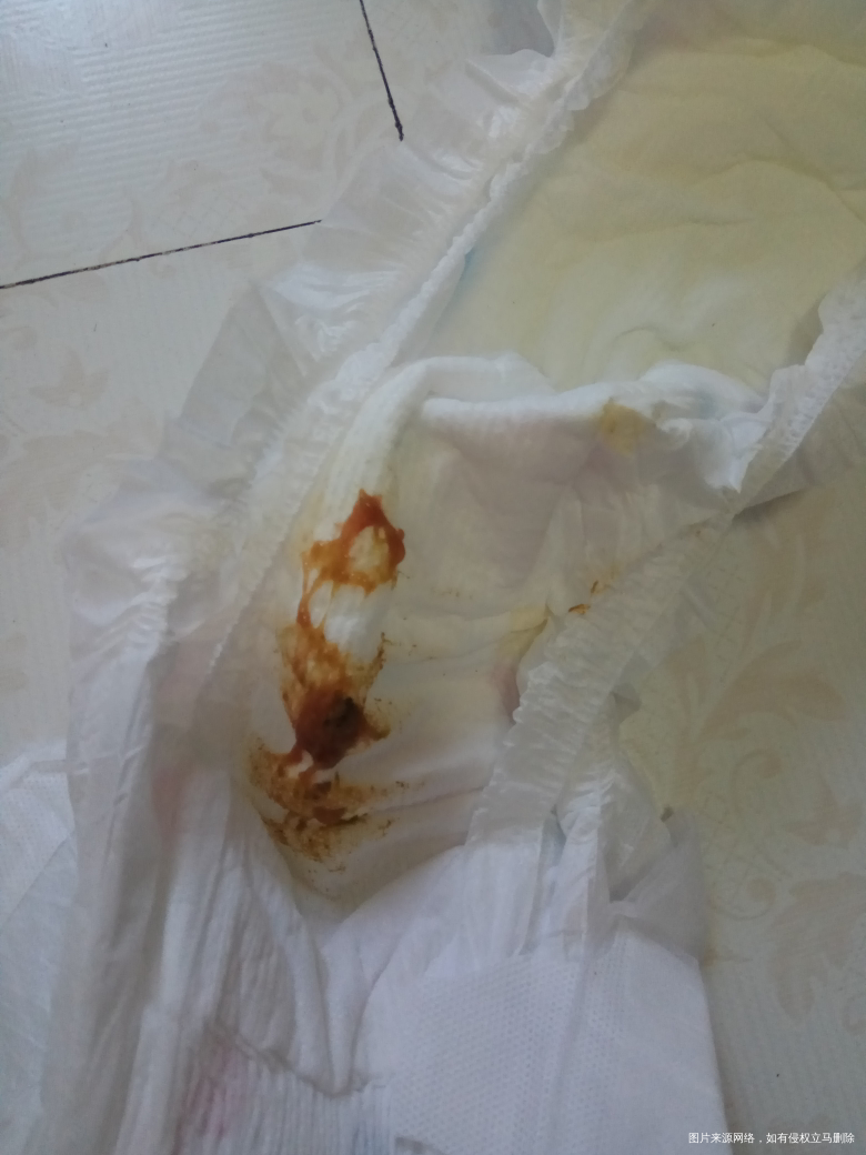 一岁半宝宝拉肚子 大便有粘液