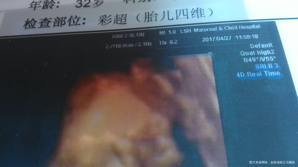 来猜猜胎儿性别。娱乐一下