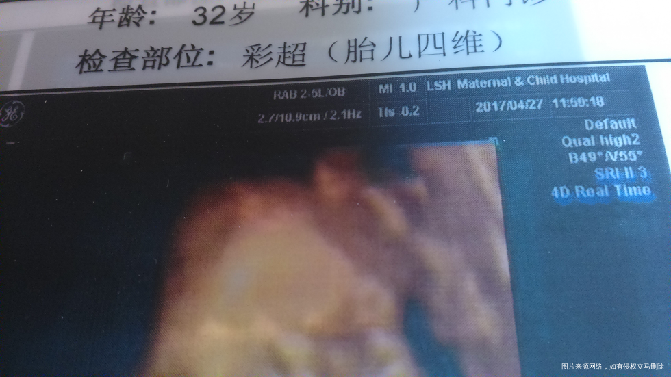 来猜猜胎儿性别。娱乐一下