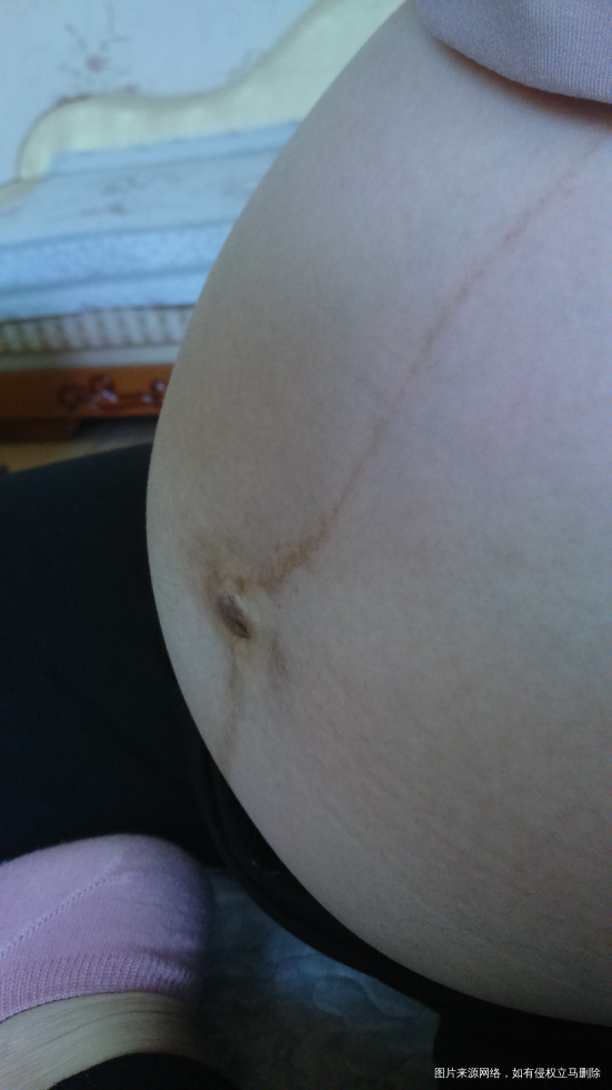 来猜猜胎儿性别。娱乐一下