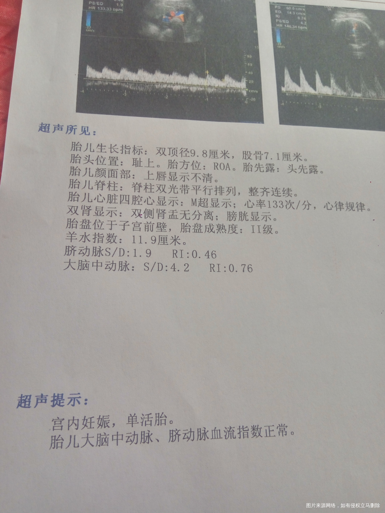 宝宝双顶径9.8,能否顺利顺产?