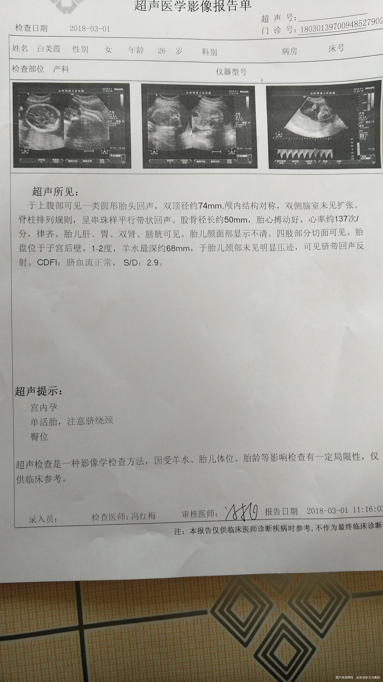 
昨天检查除了胎位有点偏,其他的都正常,5月14号预产期,有没有同一天的啊