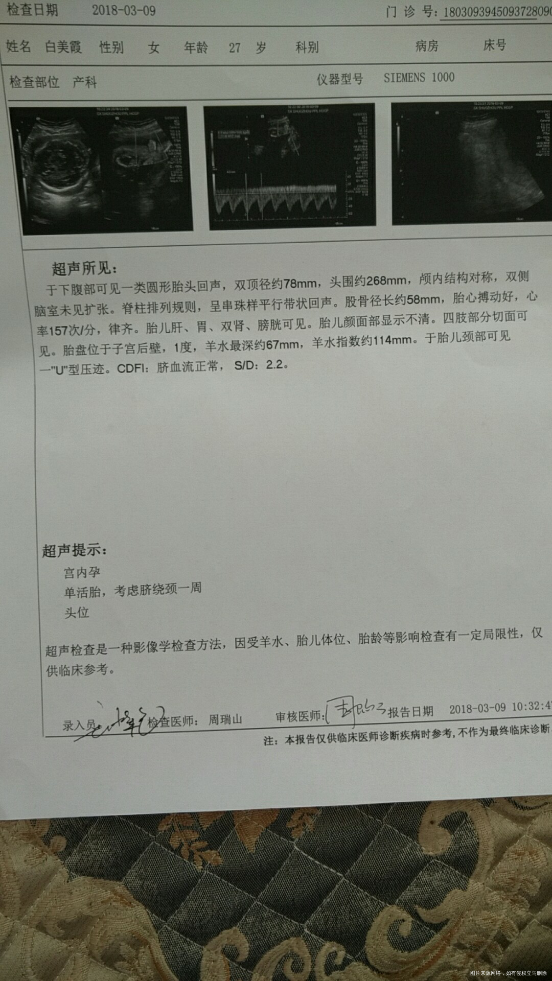 1号检查说胎位偏,经过一个多星期与宝宝的配合努力,今天去检查胎位终于转正了,宝宝...
