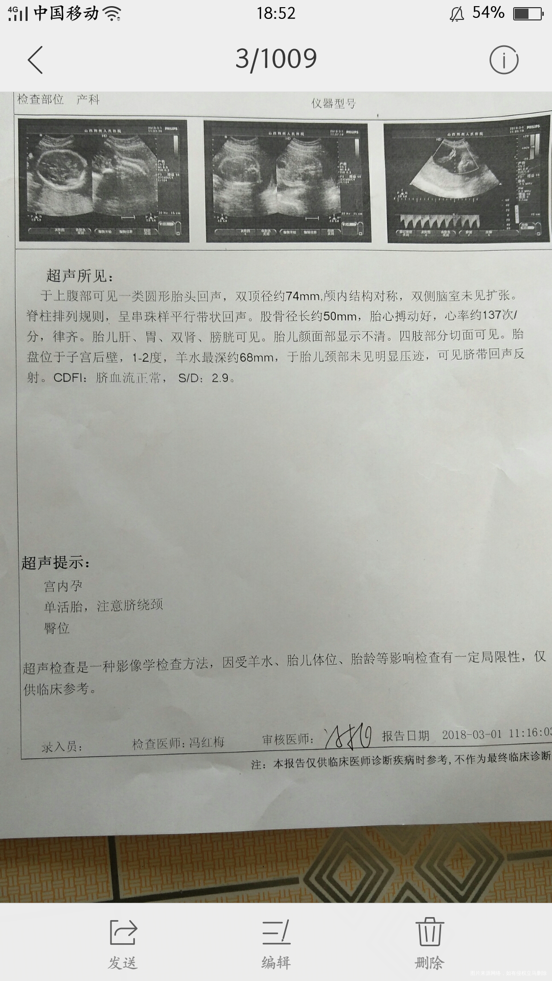 1号检查说胎位偏,经过一个多星期与宝宝的配合努力,今天去检查胎位终于转正了,宝宝...