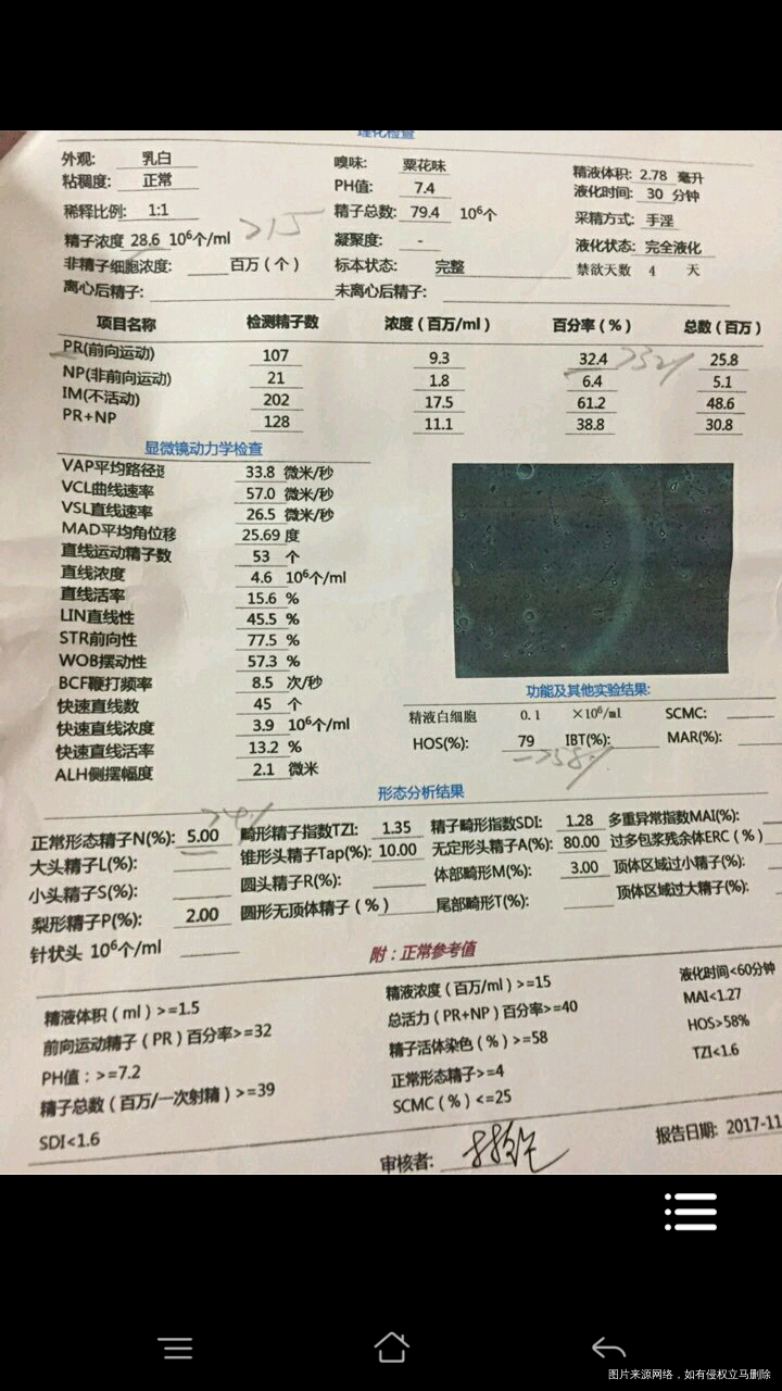 帮忙看看我老公的精液报告有什么问题