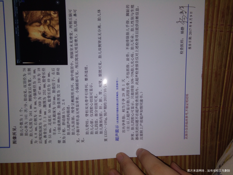 给未出生宝宝的一封信😗😗