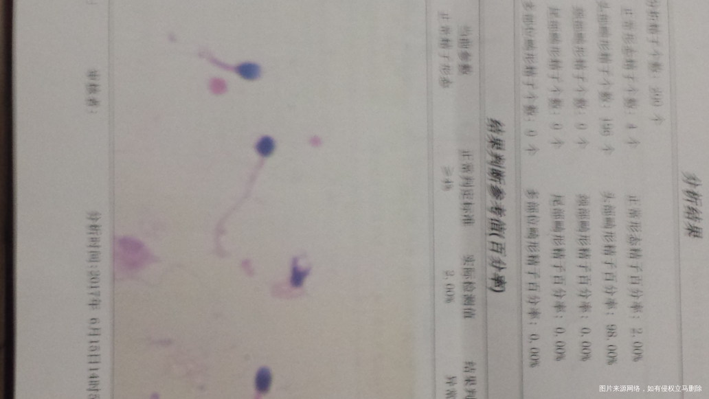 在线医生帮忙看一下有问题吗?