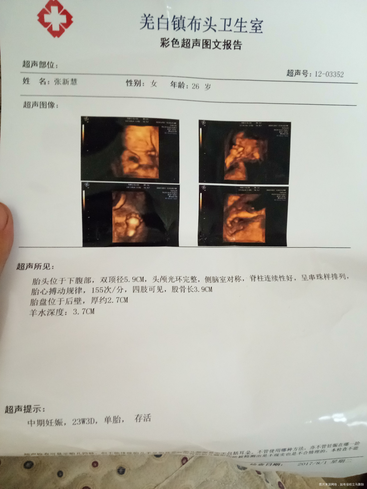 今天24周做的四维!羊水少的很还浑浊怎么办啊!