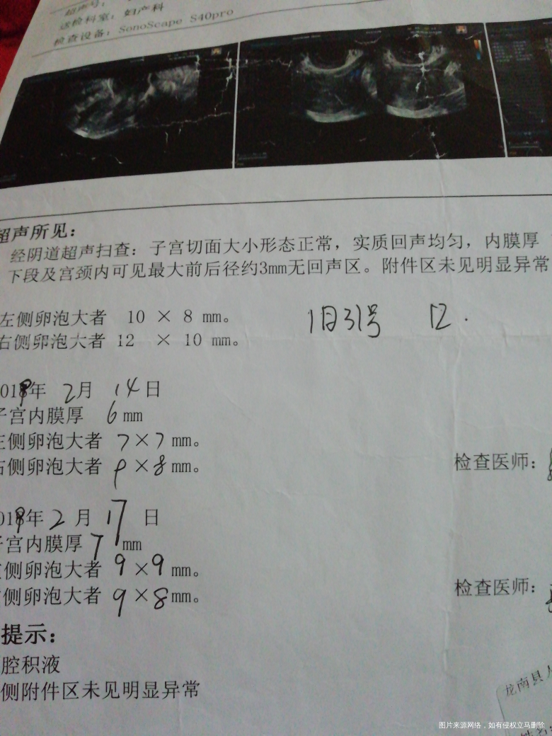 从去年的八月左右备孕,到现在没成功。一开始什么都没去信,直接同房,后来在tb看到...