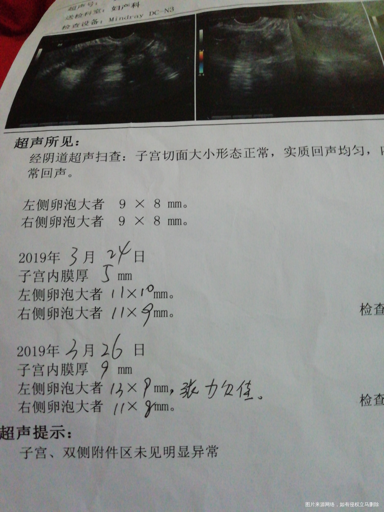 从去年的八月左右备孕,到现在没成功。一开始什么都没去信,直接同房,后来在tb看到...