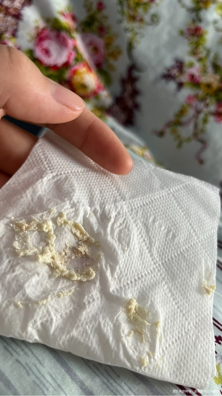 移植58天,雪诺酮上面有粉色的分泌物