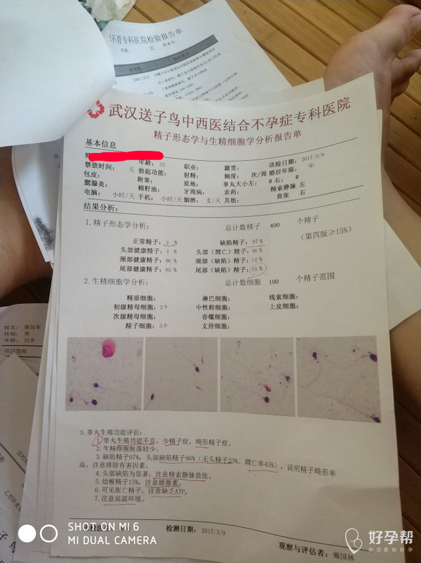 帮我精子成活率这么低,可以做人授吗