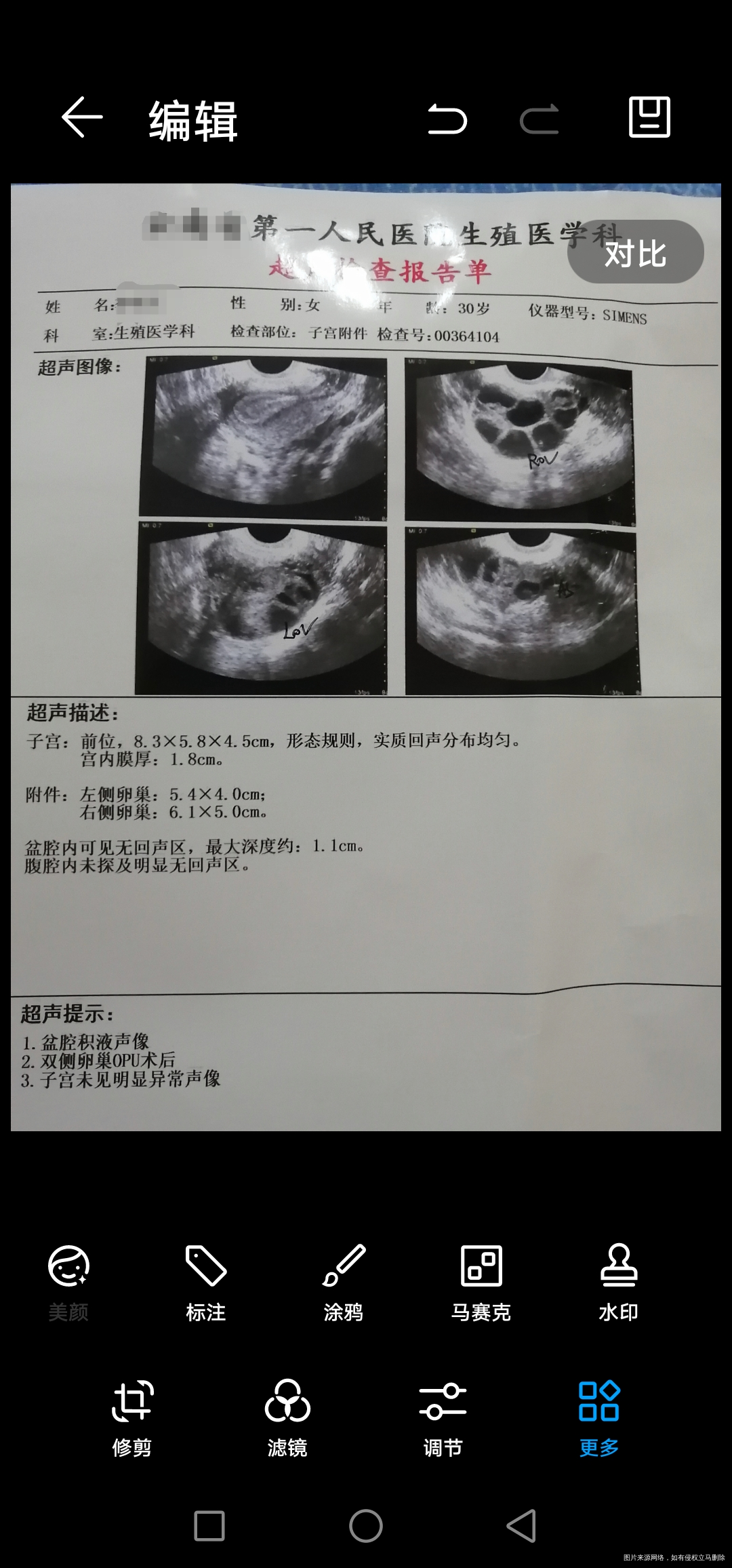 医生你好,麻烦帮我看一下