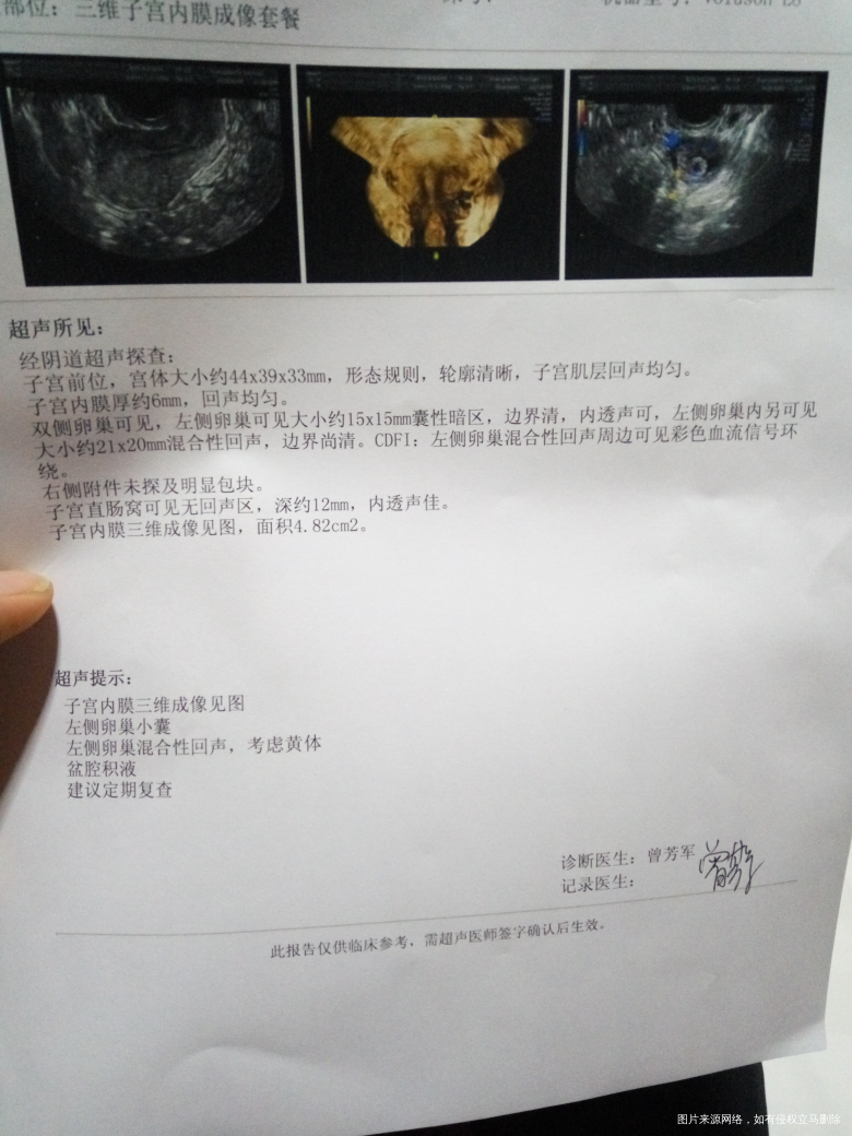 请医师们帮忙看看B超单