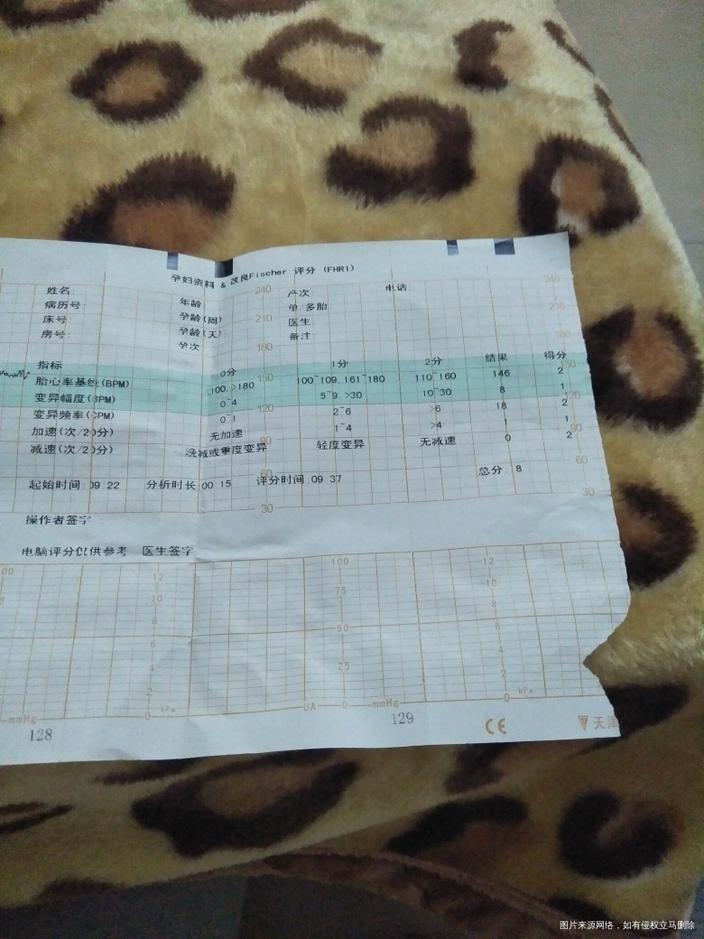 各位医生这是今天做的胎监才8分