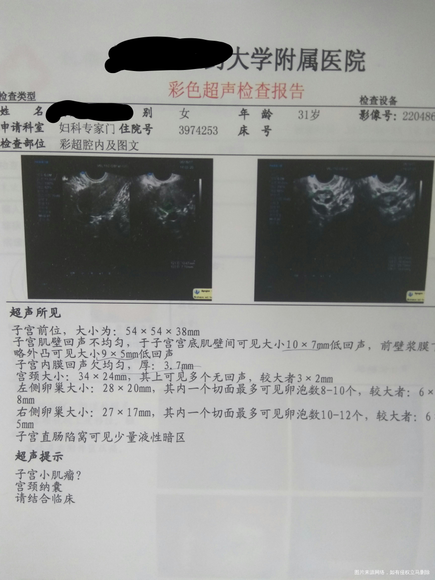 请医生帮我看一下彩超单,月经第六天拍的!