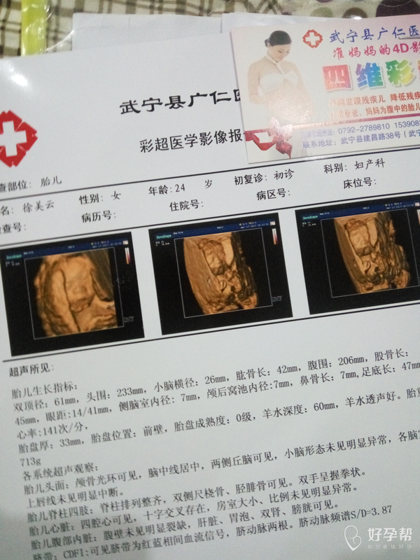 四维彩超能看出男女吗大家来帮忙看看